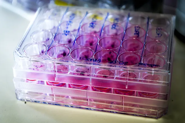 Detail image from diabetes lab.